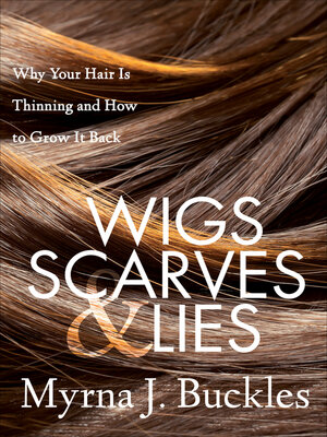 cover image of Wigs, Scarves & Lies